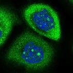 Immunofluorescent staining of human cell line A-431 shows positivity in nucleoli & cytoplasm.