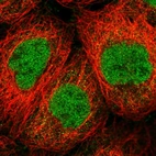Immunofluorescent staining of human cell line A-431 shows localization to nucleoplasm.