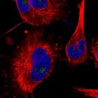 Anti-MED16 Antibody