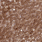 Anti-TONSL Antibody