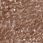 Anti-TONSL Antibody