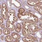 Immunohistochemical staining of human kidney shows strong cytoplasmic granular positivity in cells in tubules.