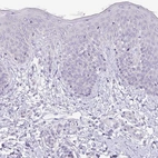 Immunohistochemical staining of human skin shows negative positivity in squamous epithelial cells as expected.