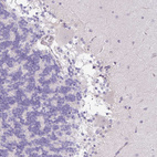 Immunohistochemical staining of human cerebellum shows negative positivity in purkinje cells as expected.