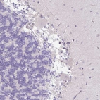 Immunohistochemical staining of human cerebellum shows negative positivity in purkinje cells as expected.