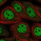 Immunofluorescent staining of human cell line MCF7 shows localization to nucleoplasm.