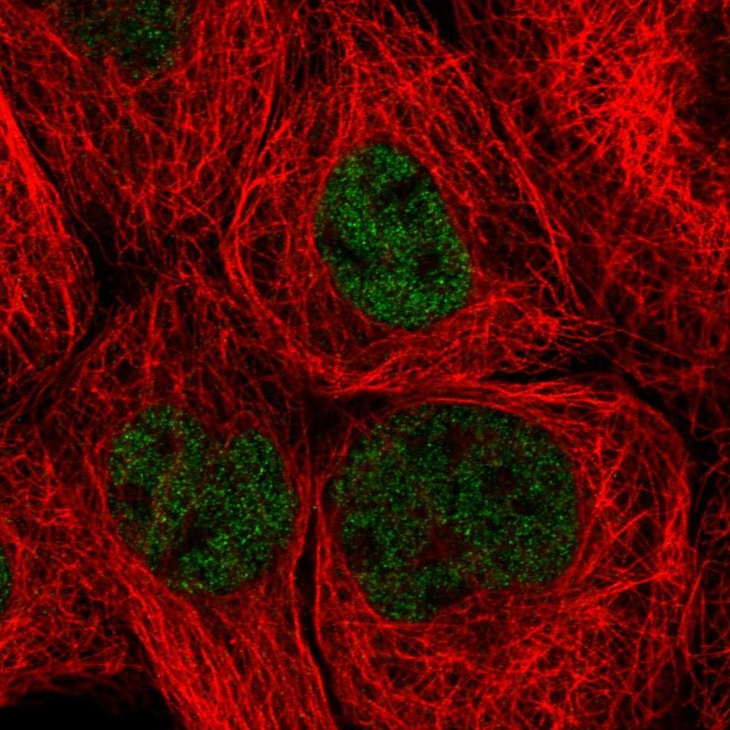 Anti-ZHX3 Antibody
