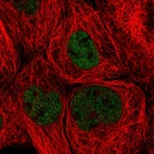 Anti-ZHX3 Antibody