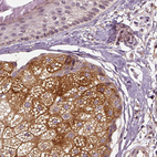 Anti-ERV3-1 Antibody