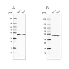 Anti-NELFE Antibody