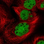 Immunofluorescent staining of human cell line A-431 shows localization to nucleoplasm & nuclear bodies.