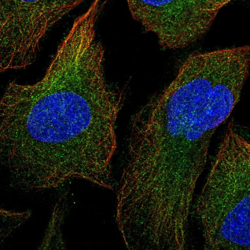 Anti-MAP3K1 Antibody