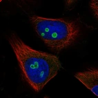 Immunofluorescent staining of human cell line U-251 MG shows localization to nucleoli.