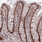 Immunohistochemical staining of human colon shows strong nuclear positivity in glandular cells.
