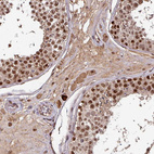 Immunohistochemical staining of human testis shows strong nuclear positivity in cells in seminiferous ducts.