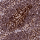 Immunohistochemical staining of human lymph node shows strong nuclear positivity in germinal center cells.