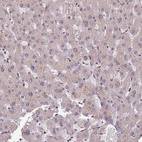 Immunohistochemical staining of human liver shows no nuclear positivity in hepatocytes as expected.