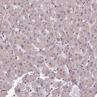 Immunohistochemical staining of human liver shows no nuclear positivity in hepatocytes as expected.