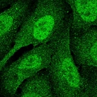 Immunofluorescent staining of human cell line U-2 OS shows localization to nucleoplasm & cytosol.