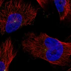 Immunofluorescent staining of human cell line U-251 MG shows localization to centrosome.