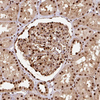 Immunohistochemical staining of human kidney shows strong nuclear positivity in cells in glomeruli.