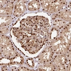 Immunohistochemical staining of human kidney shows strong nuclear positivity in cells in glomeruli.