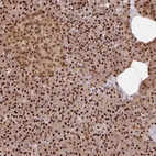 Immunohistochemical staining of human pancreas shows strong nuclear positivity in exocrine glandular cells.