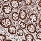 Immunohistochemical staining of human colon shows strong nuclear positivity in glandular cells.