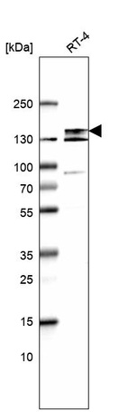 Western blot analysis in human cell line RT-4.