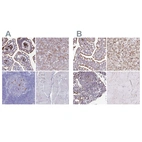 Immunohistochemical staining of human gastrointestinal, liver, lymph node and skeletal muscle using Anti-FUCA1 antibody HPA046542 (A) shows similar protein distribution across tissues to independent antibody HPA056371 (B).