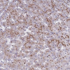 Immunohistochemical staining of human liver shows strong granular cytoplasmic positivity in hepatocytes.