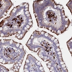 Immunohistochemical staining of human small intestine shows strong granular cytoplasmic positivity in glandular cells.