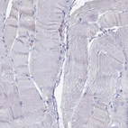 Immunohistochemical staining of human skeletal muscle shows no positivity in myocytes as expected.