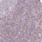 Anti-FPR1 Antibody