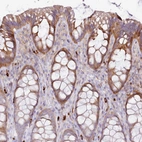 Immunohistochemical staining of human colon shows moderate cytoplasmic positivity in glandular cells and strong cytoplasmic positivity in subset of lymphoid cells.