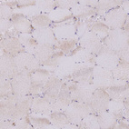 Anti-FPR1 Antibody