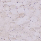 Immunohistochemical staining of human skeletal muscle shows weak cytoplasmic positivity in myocytes.
