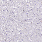 Immunohistochemical staining of human liver shows no positivity in hepatocytes as expected.