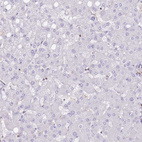 Anti-FPR1 Antibody