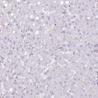 Immunohistochemical staining of human liver shows no positivity in hepatocytes as expected.