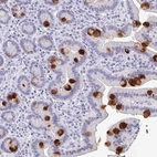 Immunohistochemical staining of human duodenum shows strong positivity in mucus in goblet cells.