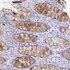 Immunohistochemical staining of human rectum shows moderate cytoplasmic positivity in goblet cells.