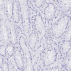 Immunohistochemical staining of human stomach shows no positivity in a subset of glandular cells.