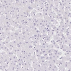 Immunohistochemical staining of human liver shows no positivity as expected.