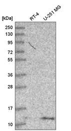 Anti-DYNLT1 Antibody