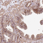 Anti-NDUFAF4 Antibody