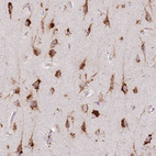 Anti-TMEM229B Antibody