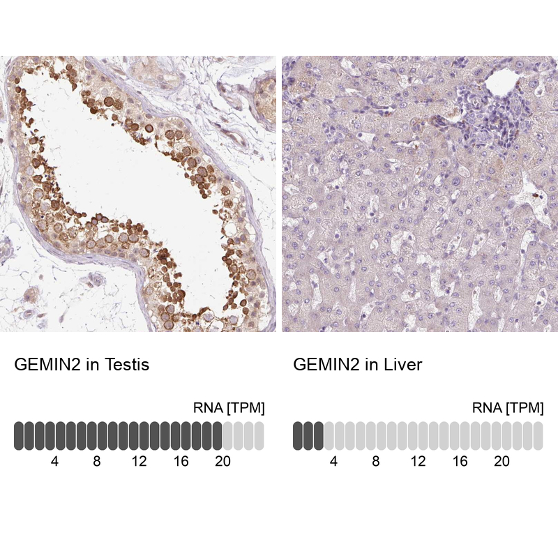 Anti-GEMIN2 Antibody