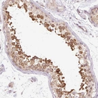 Immunohistochemical staining of human testis shows high expression.
