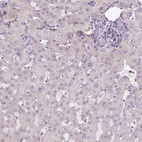 Immunohistochemical staining of human liver shows low expression as expected.